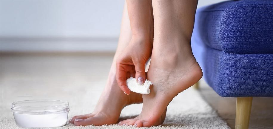 Cracked Heels: Causes, Treatment, Prevention, and Smooth Solutions