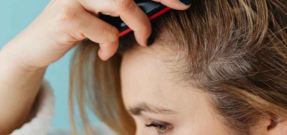 Effective Dandruff Solutions: How to Get Rid of Dandruff Fast & Naturally