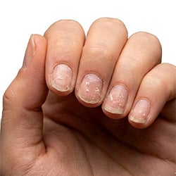 Strengthen brittle nails