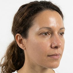 Skincare for Combination Skin