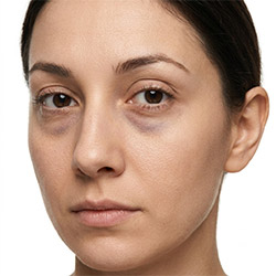 Eye care products for reducing the appearance of dark circles and tired looking eyes
