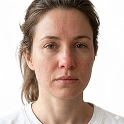Dryness and Irritation Skincare