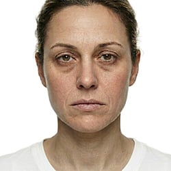 Skin rejuvenation skincare products for refreshed looking skin