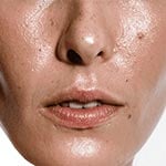 Skincare for Oily Skin