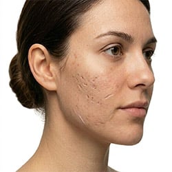 Skincare products for visible scars and uneven skin texture on face and body
