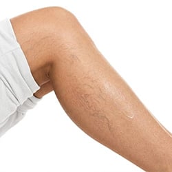 Foot skincare products for improving the appearance of visible veins and skin texture